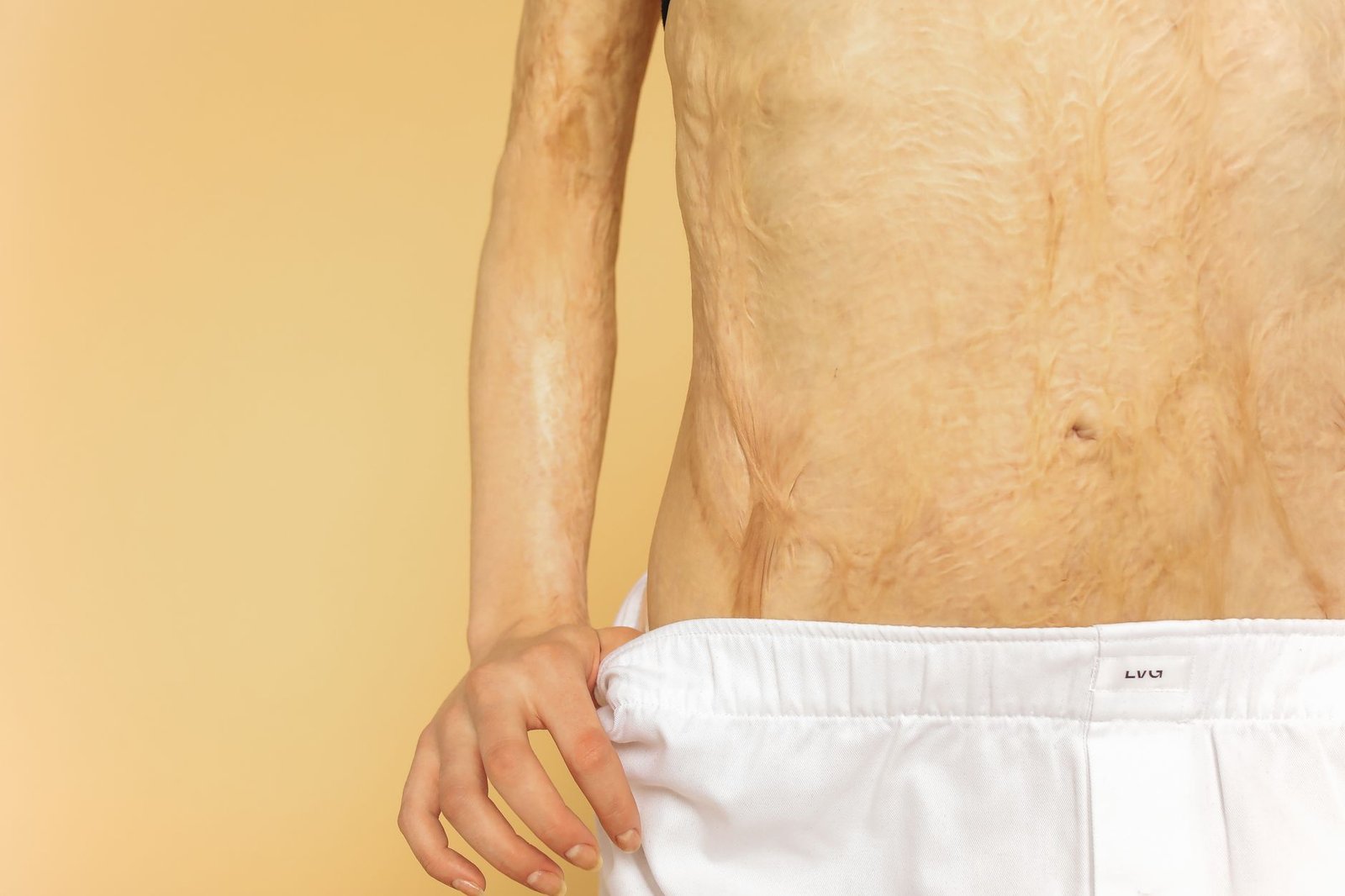mecanismo bioestimulação colágeno pele masculina fases regeneração