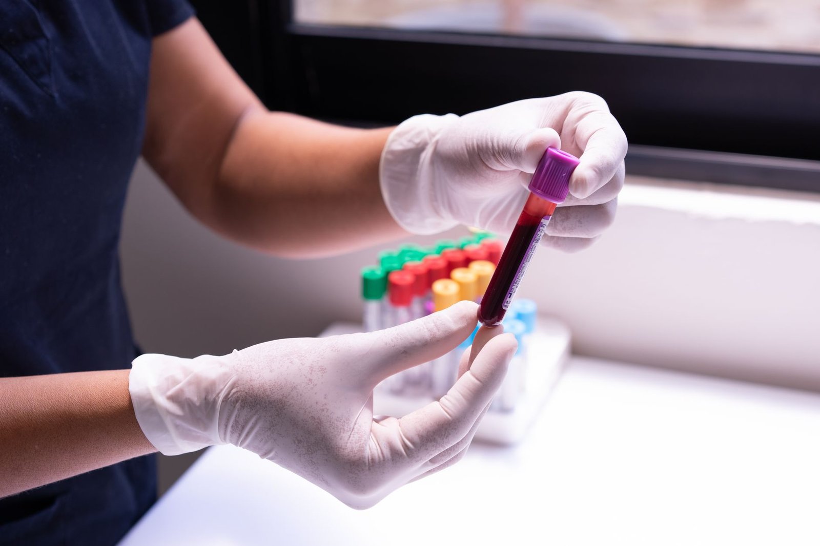 acompanhamento médico terapia reposição testosterona exames periódicos hipogonadismo