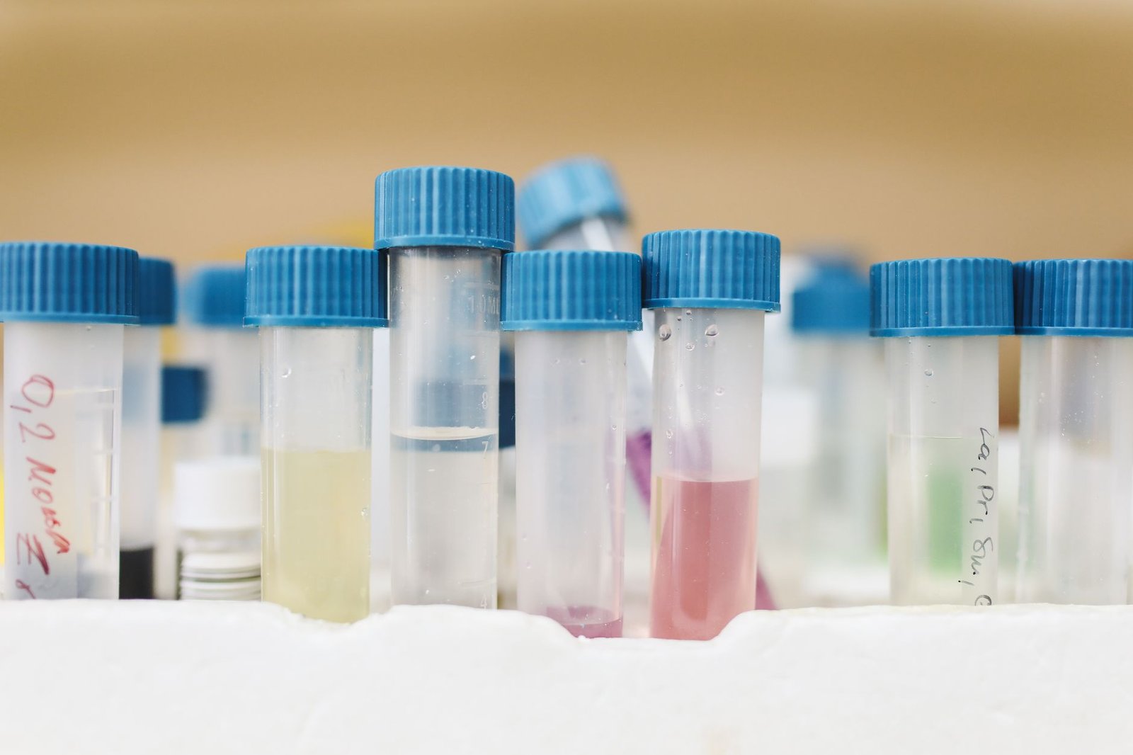 painel de exames laboratoriais para avaliação hormonal masculina pré-implante
